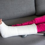 شخصی با پای شکسته روی یک مبل با قابلیتهای بسیار پیشرفته